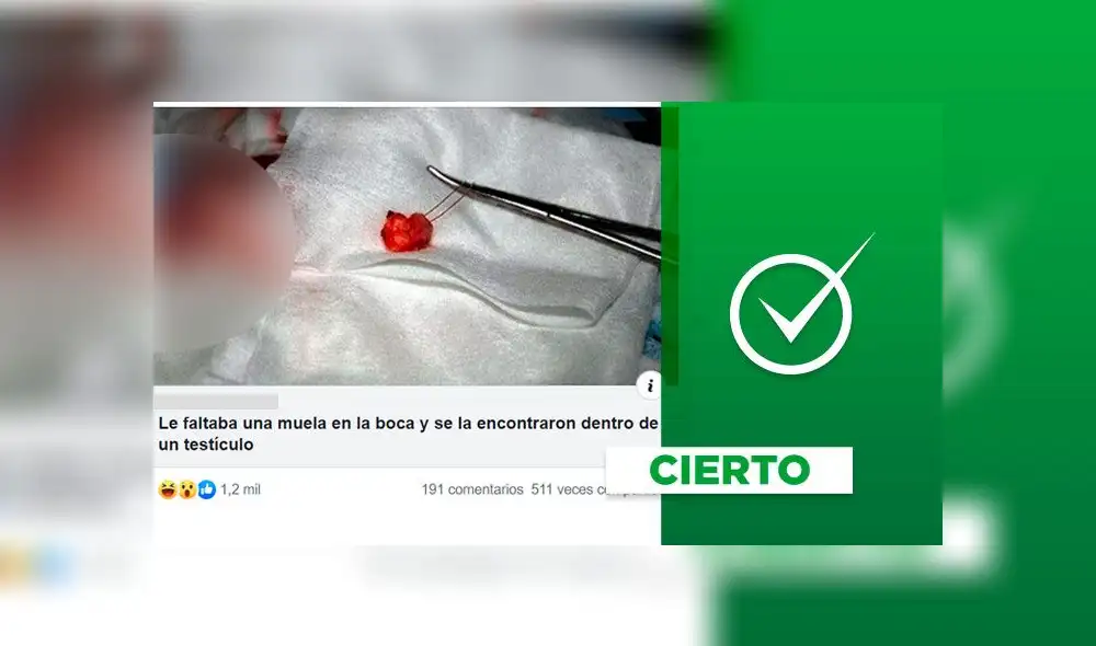 Médico "extrajo un diente” del testículo de un menor al que le faltaba un molar