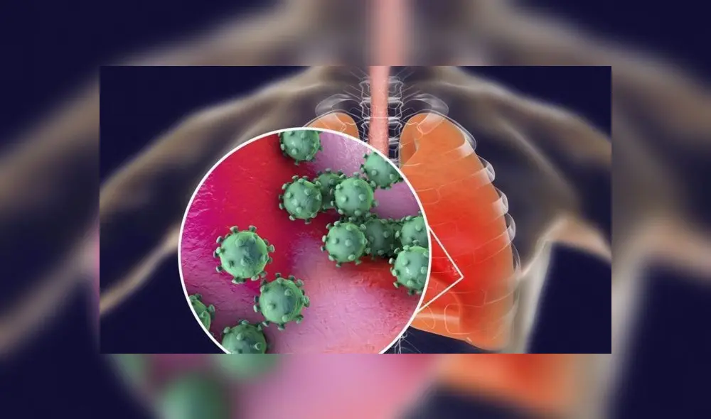 Uno de los efectos del COVID-19 es inflamación de los pulmones. Foto: Getty Images.