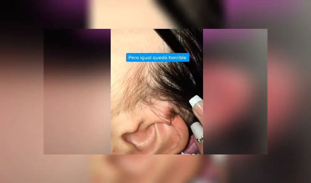 Desliza las imágenes para ver lo que pasó con esta joven y el piercing que se hizo en la oreja. Foto: Luna Fernández/TikTok Desliza las imágenes para ver lo que pasó con esta joven y el piercing que se hizo en la oreja. Foto: Luna Fernández/TikTok