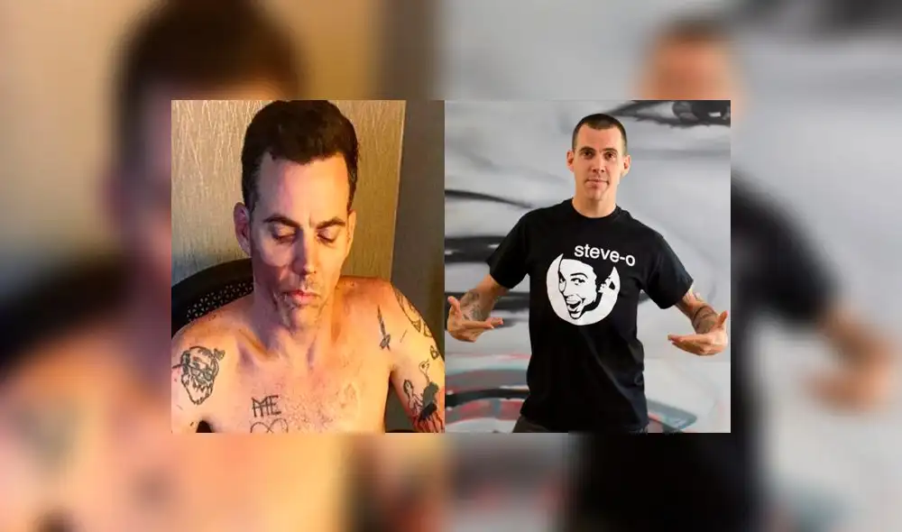 Jackass: Steve-O sufrió la lesión más severa de su carrera y lo comparte en Instagram  [VIDEO]