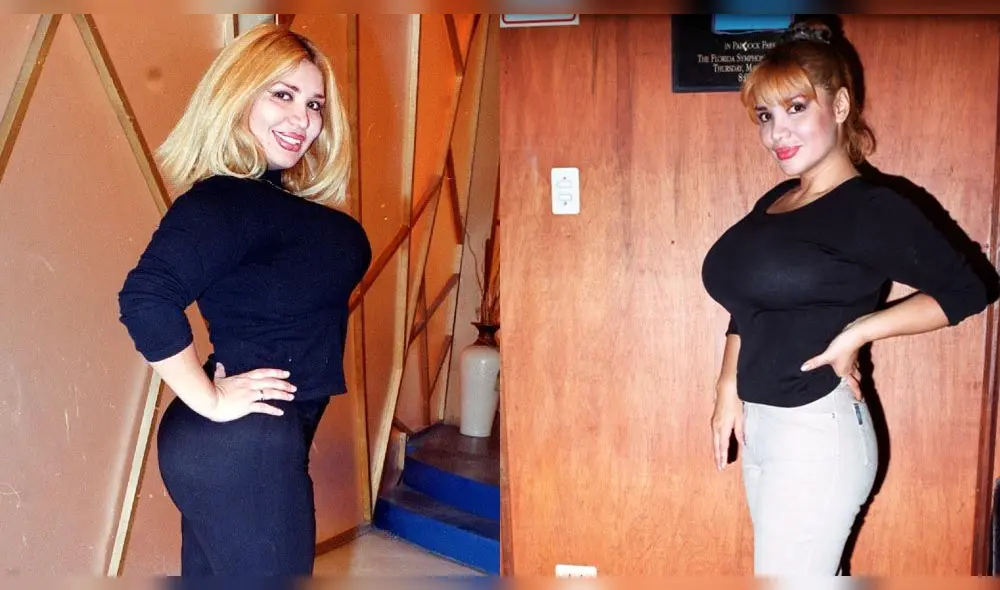 Lucy Cabrera, su antes y después al bajar de peso con banda gástrica