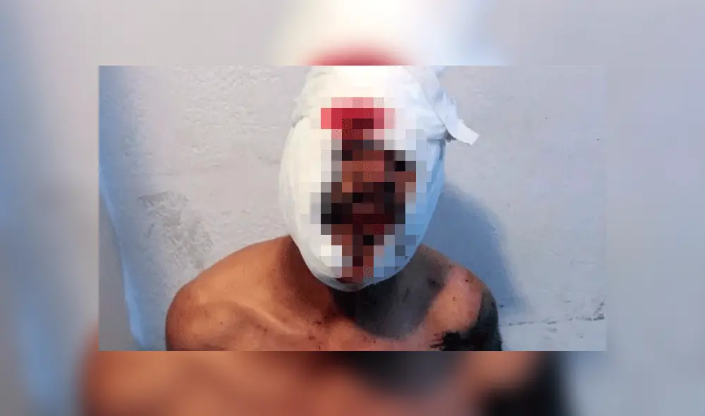 José Luis “El Crucero” Floco, fue brutalmente agredido.