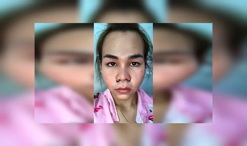 Vía Facebook: asiática se harta de ser el 'patito feo' y cambia su aspecto con rigurosas cirugías [FOTOS]