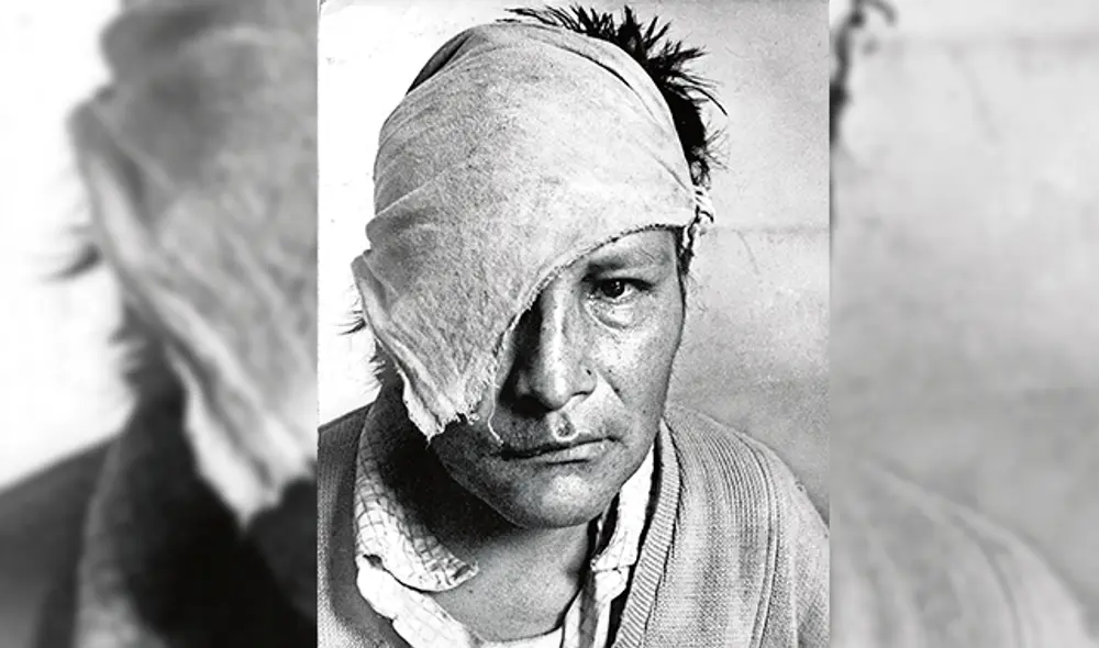 Rostro. Edmundo Camana sobrevivió a la matanza senderista a machetazos en Lucanamarca. Medrano lo halló y ayudó para su traslado a Lima. Aquí murió de modo inexplicable. Rostro. Edmundo Camana sobrevivió a la matanza senderista a machetazos en Lucanamarca. Medrano lo halló y ayudó para su traslado a Lima. Aquí murió de modo inexplicable.