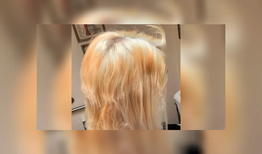 Facebook: Así quedó una joven que intentó decolorarse el cabello con lejía [FOTOS]