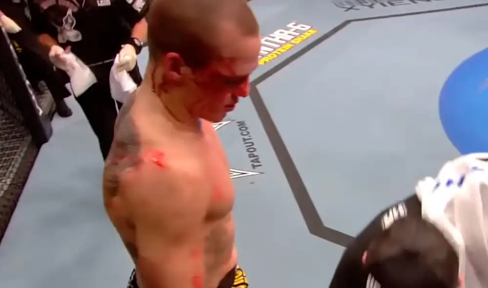 'Cowboy' Cerrone debutó ante Kelly en 2011. Foto: UFC