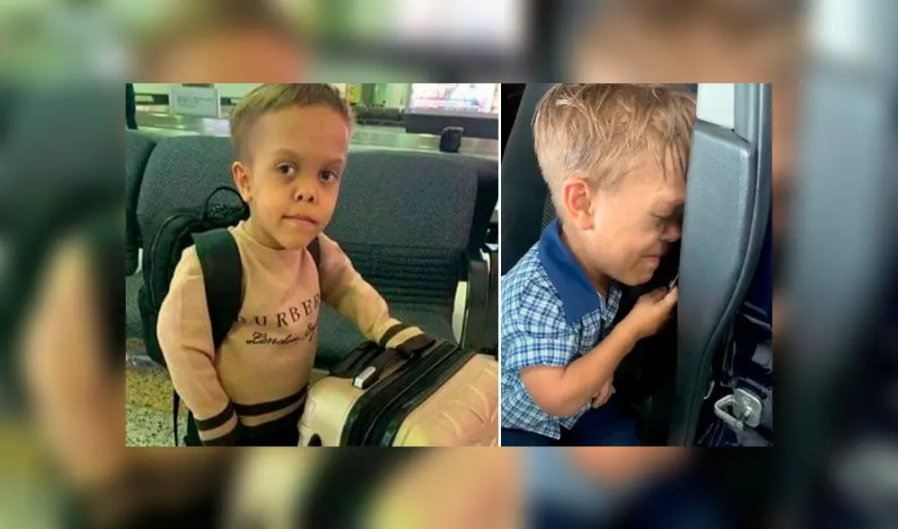 Quaden Baileys padece de acondroplasia desde que nació. Foto: Composición