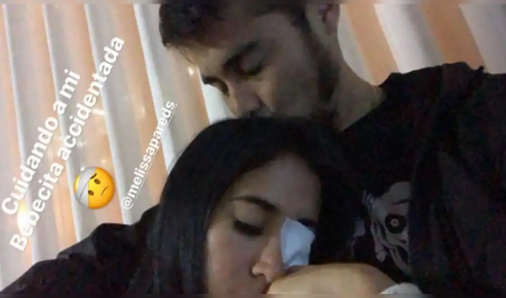 Así luce Melissa Paredes tras sufrir accidente en el rostro  [VIDEO]