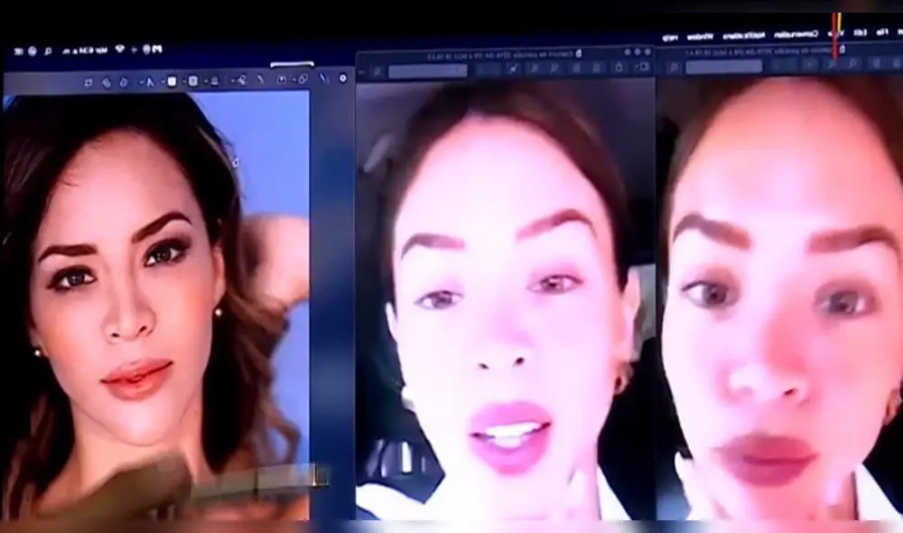 Sheyla Rojas pagó más de 20 mil soles en cirugías de cara y cuerpo, según expertos Sheyla Rojas pagó más de 20 mil soles en cirugías de cara y cuerpo, según expertos