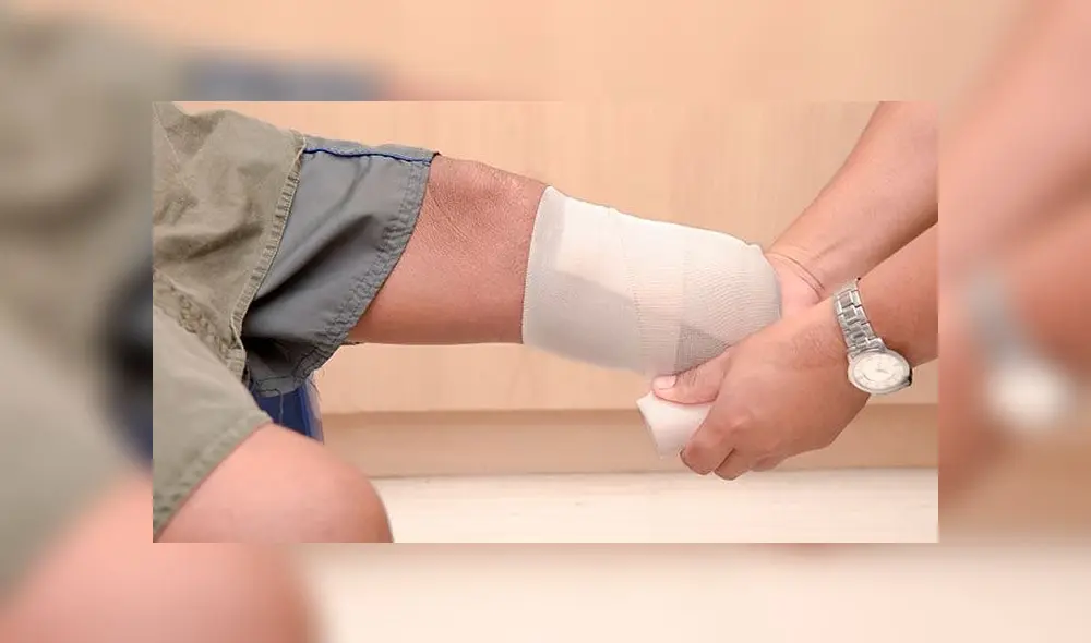 La mujer fue amputada de sus extremidades en el 2013.