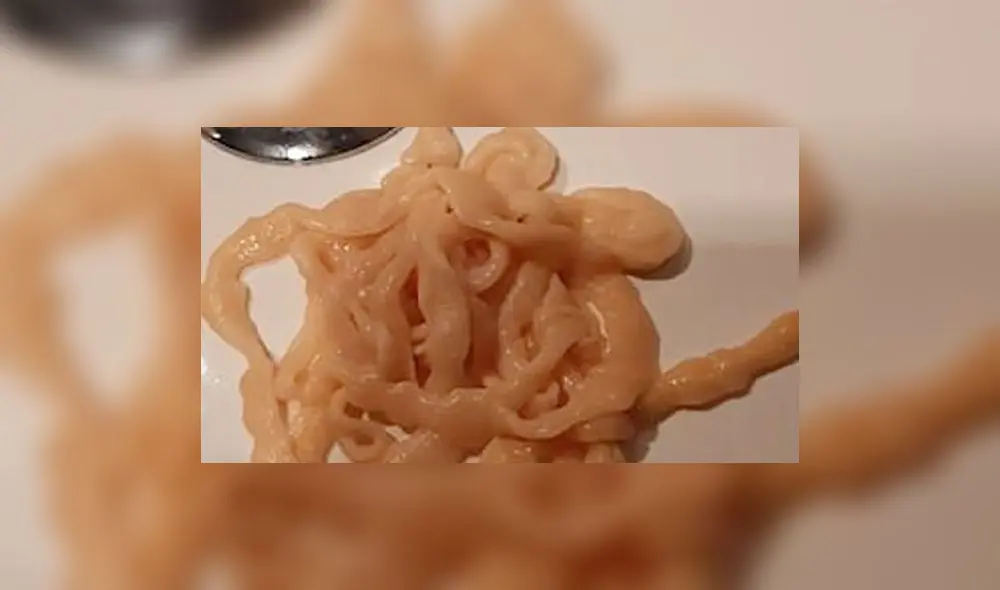 Un tailandés horrorizado tras expulsar una tenia gigante. Foto: Facebook. Un tailandés horrorizado tras expulsar una tenia gigante. Foto: Facebook.