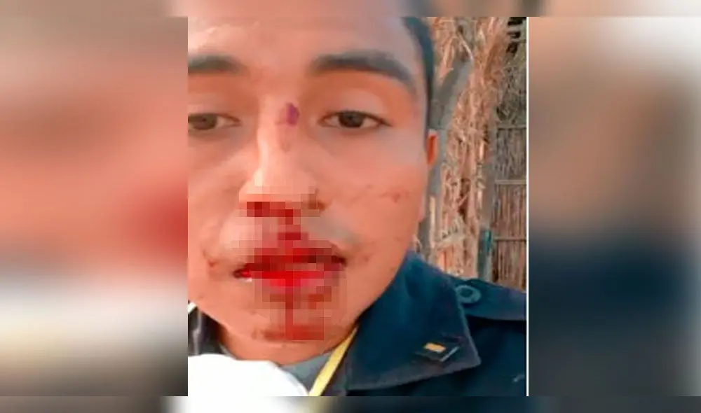 Oficial de la PNP denunció haber sido agredido por dos sujetos en Piura. Oficial de la PNP denunció haber sido agredido por dos sujetos en Piura.