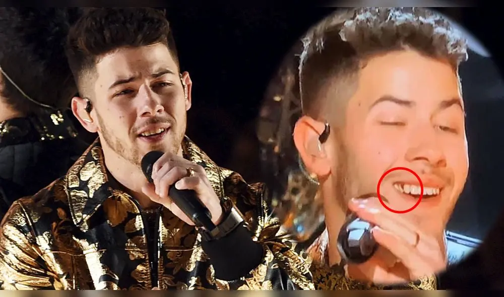 Nick Jonas recibe críticas por cantar con los dientes sucios