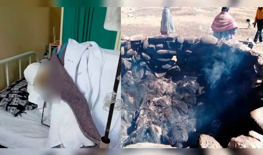 Niño que sobrevivió al incendio de su casa en Puno necesita ayuda económica.