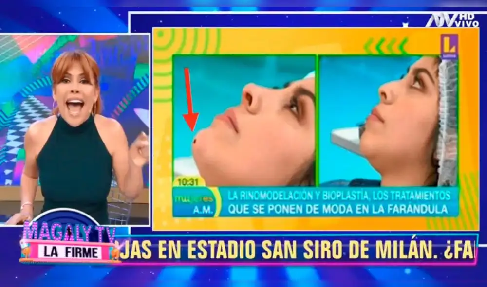 La figura de ATV cuestionó al programa por mostrar intervención quirúrgica en horas de la mañana.