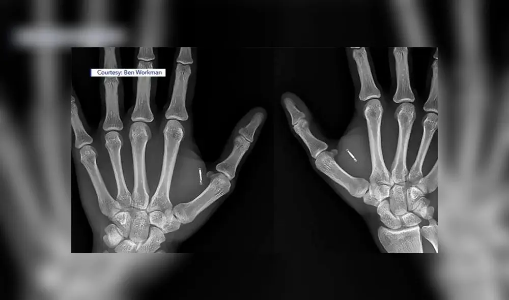 El hombre domina uno de los mayores inventos de Elon Musk tras inyectarse chips en sus manos. Foto: Ben Workman El hombre domina uno de los mayores inventos de Elon Musk tras inyectarse chips en sus manos. Foto: Ben Workman