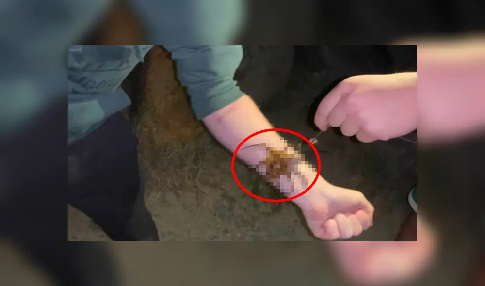 Una transmisión en vivo en Facebook muestra a la letal criatura que caminó sobre el brazo de un joven.