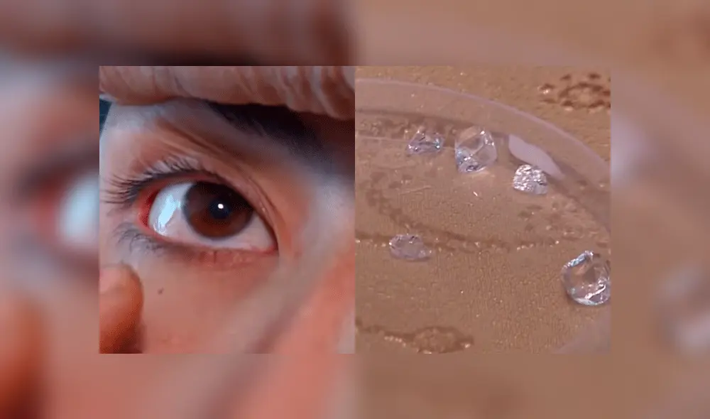 El viceministro de Salud de Armenia indicó que se realizará un foro para abordar las posibles causas. Foto: Captura