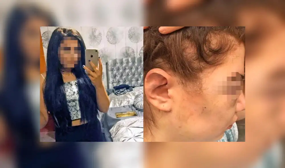 La mujer llegó al hospital con graves lesiones en el rostro. (Captura: The Sun) La mujer llegó al hospital con graves lesiones en el rostro. (Captura: The Sun)