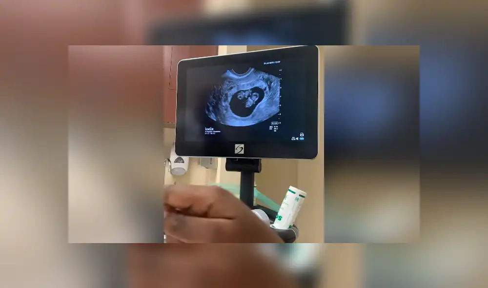 La mujer se emocionó luego de que le dijeran que iba a tener gemelos. Foto: YouTube La mujer se emocionó luego de que le dijeran que iba a tener gemelos. Foto: YouTube