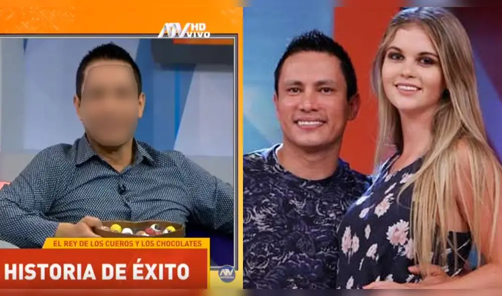 Renzo Costa reaparece en TV con sorprendente cambio en su rostro [VIDEO]