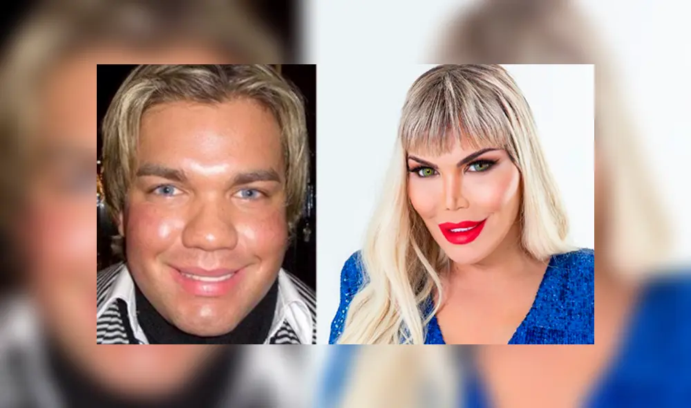 Facebook viral: ‘Ken humano’, muestra su rostro antes de las cirugías y su aspecto deja sorprendido a miles. Foto: Rodrigo Alves.