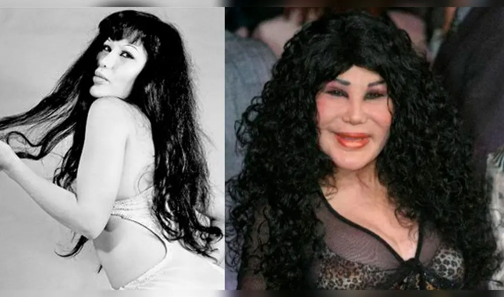 Lyn May antes y después