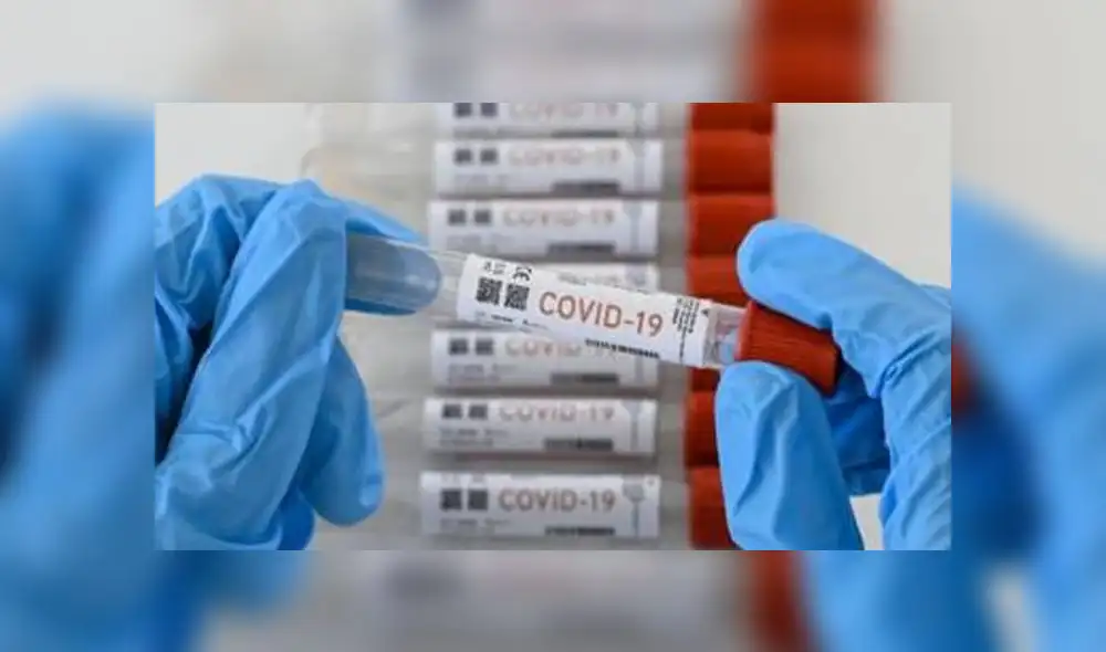 Aumento de casos pese a disminución de pruebas por el Minsa. Foto: BBC Aumento de casos pese a disminución de pruebas por el Minsa. Foto: BBC