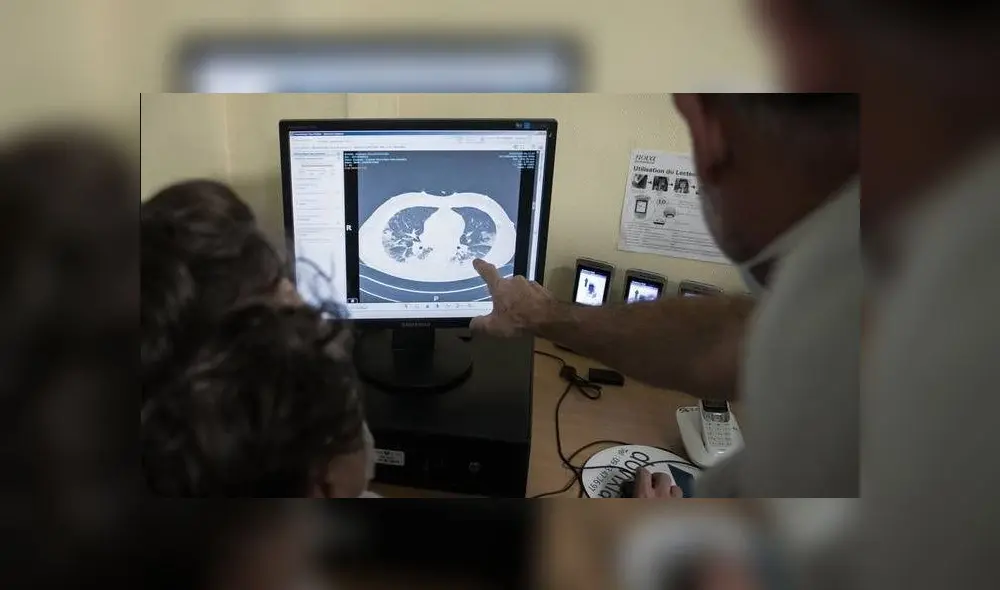 El tejido pulmonar de la mujer tenía presencia del virus y se encontraba dañado. Foto: referencial /AFP.