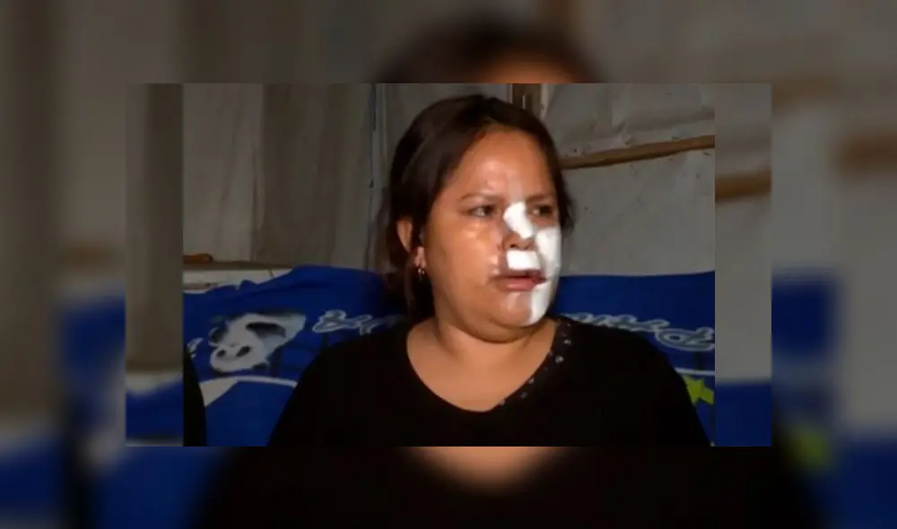 Su expareja también recibió varios golpes en el rostro y en el cuerpo cuando intentaba defenderla.