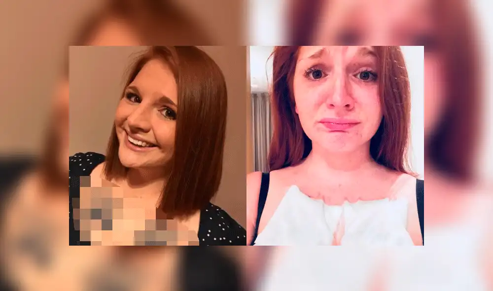 Facebook: Se hizo peculiar tatuaje en los pechos en honor a su perro, pero hoy se arrepiente [FOTOS]