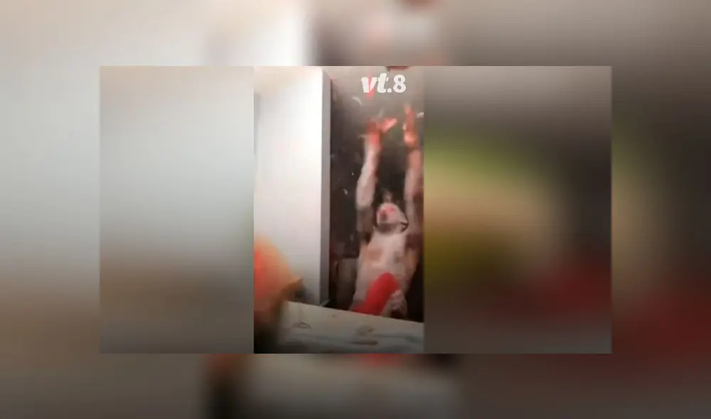 Desliza las imágenes para ver el terrible resultado que obtuvo un joven al hacer un experimento casero. Foto: VT Desliza las imágenes para ver el terrible resultado que obtuvo un joven al hacer un experimento casero. Foto: VT