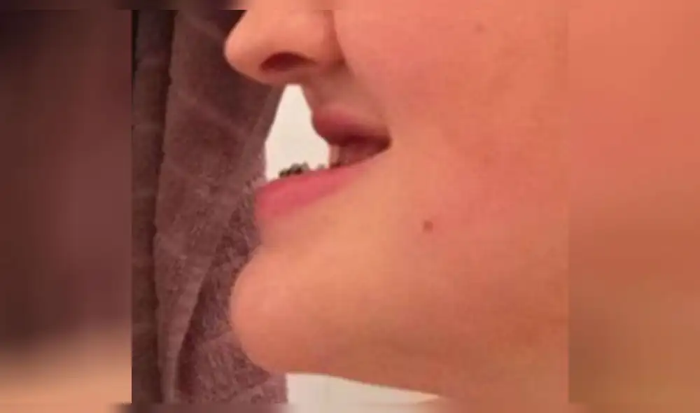 Facebook: una joven que no podía cerrar la boca luce irreconocible tras cirugía [FOTOS]