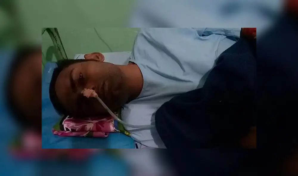 Médicos se sorprendieron al ver lo que tenía en su estómago un agricultor en la India. Newslions.
