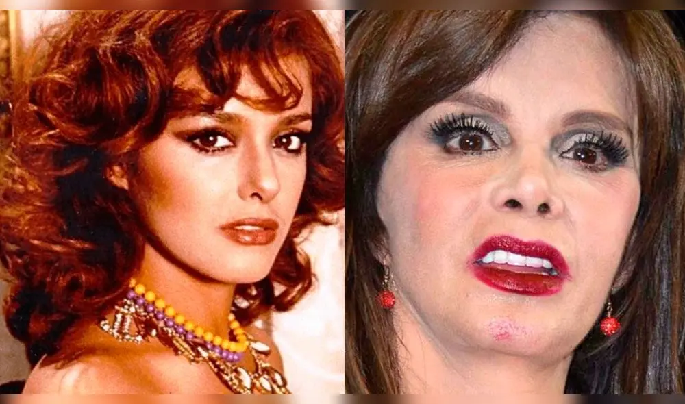 Lucía Méndez antes y después