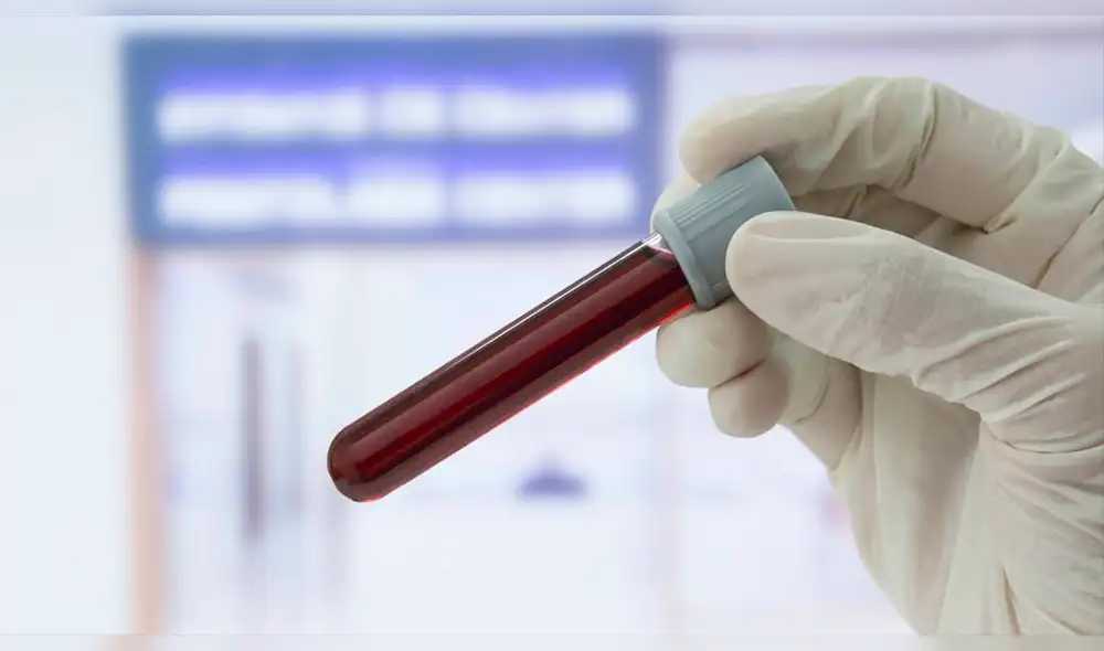 Twittter: Se realizó examen médico y descubrió oscuro secreto familiar Twittter: Se realizó examen médico y descubrió oscuro secreto familiar