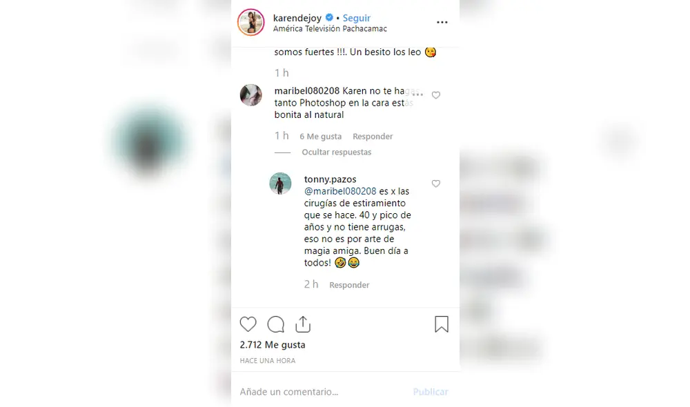 Karen Dejo se pasó de la raya con el uso de filtro en su cara para en la red social Instagram. Karen Dejo se pasó de la raya con el uso de filtro en su cara para en la red social Instagram.