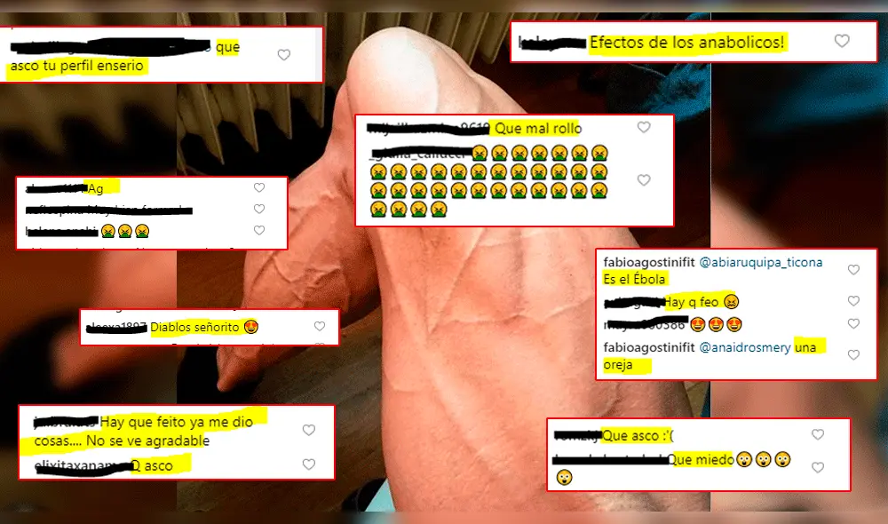 Fabio Agostini es víctima de 'haters' tras presumir parte de su cuerpo