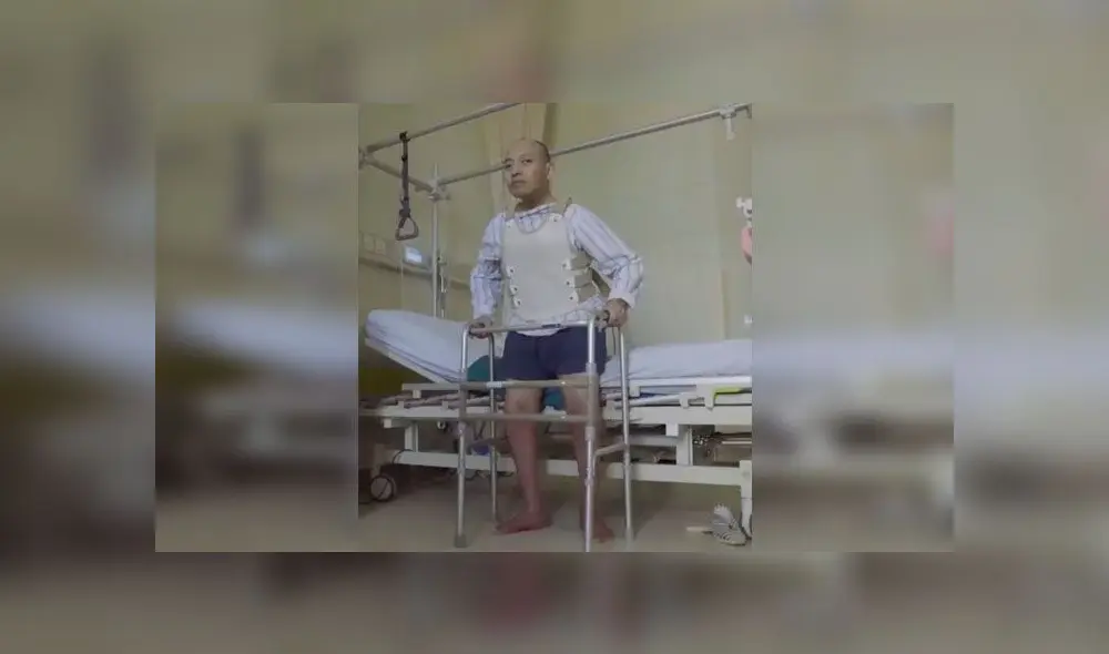 Tuvo el cuerpo doblado por casi tres décadas y volvió a la normalidad gracias a operación Tuvo el cuerpo doblado por casi tres décadas y volvió a la normalidad gracias a operación