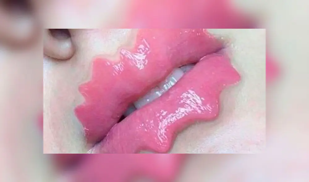 'Labios del diablo’: la polémica y peligrosa moda que causa furor en redes sociales [VIDEO]