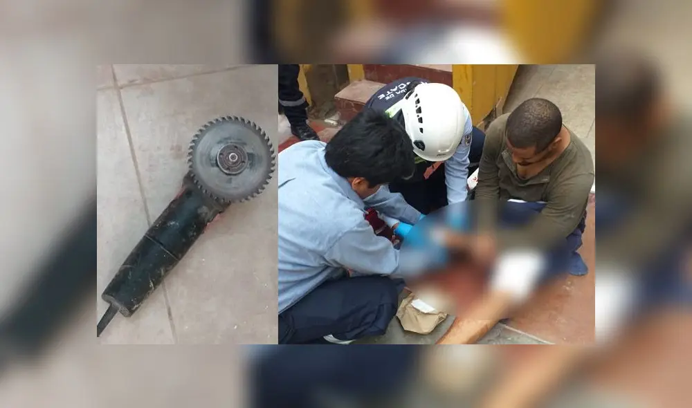 Ciuadadano dominicano se recupera en el hospital Casimiro Ulloa. (Foto: Serenazgo de Surco)