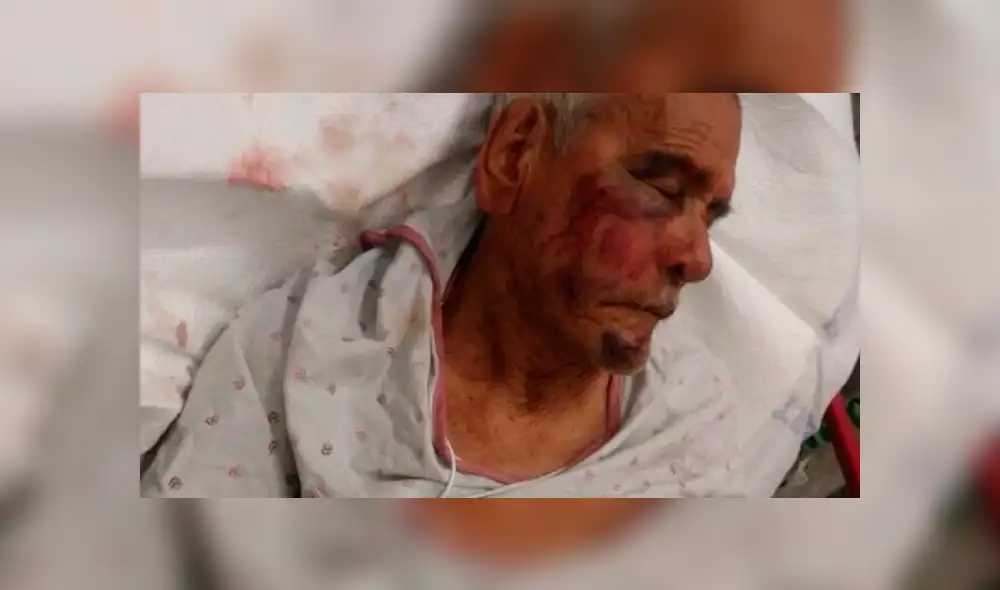 EE.UU.: Anciano de 92 años recibe brutal golpiza por ser mexicano EE.UU.: Anciano de 92 años recibe brutal golpiza por ser mexicano