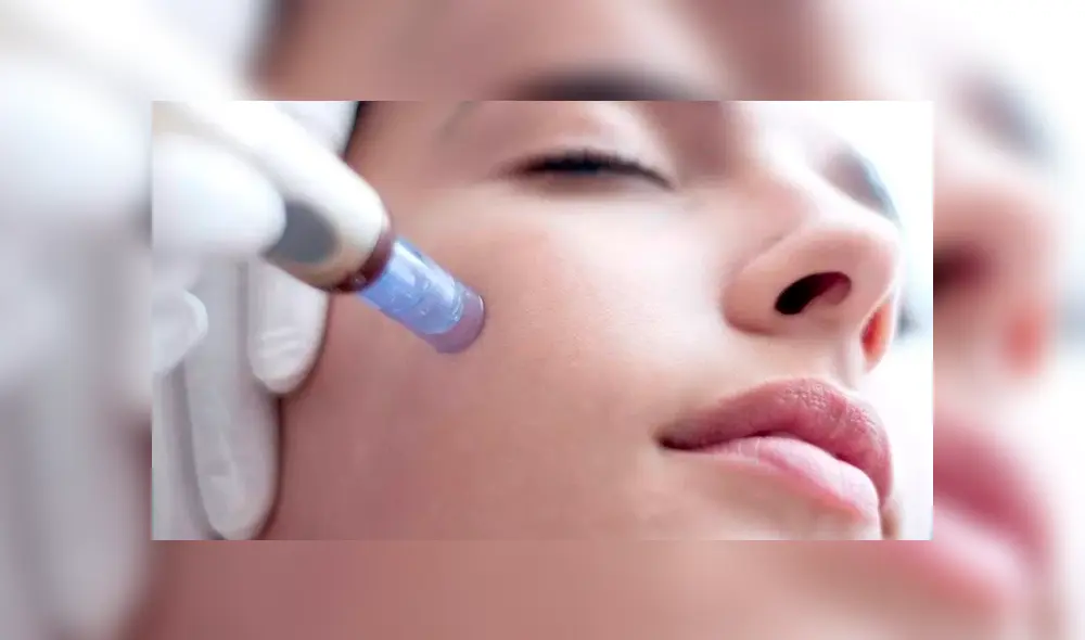 Mujeres contraen VIH al realizarse tratamiento facial de plasma