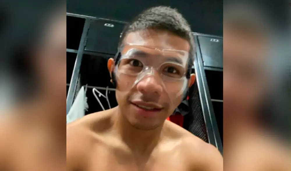 Edison Flores usará una máscara facial