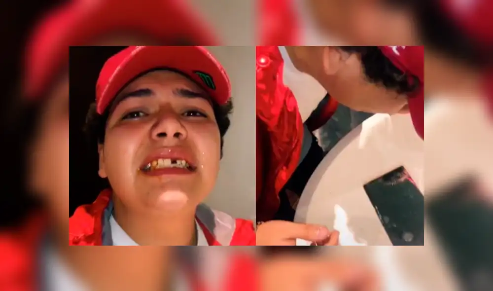 Desliza a la izquierda para ver el accidente que sufrió este joven. Foto: Captura.