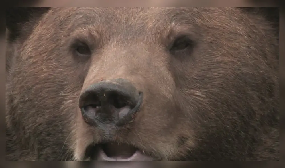 Médico revela que paciente no iba a ser devorado por osos, sino que padece de psoriasis crónica. Foto: Referencial.