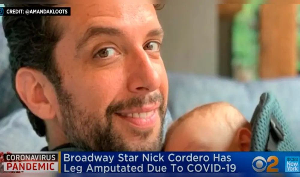 Nick Cordero, actor de Brodway, sufre la amputación de una pierna por el coronavirus Nick Cordero, actor de Brodway, sufre la amputación de una pierna por el coronavirus