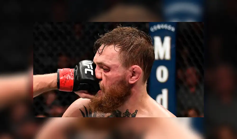 McGregor vs Khabib: Así terminó la cara del irlandés tras la derrota [FOTOS]