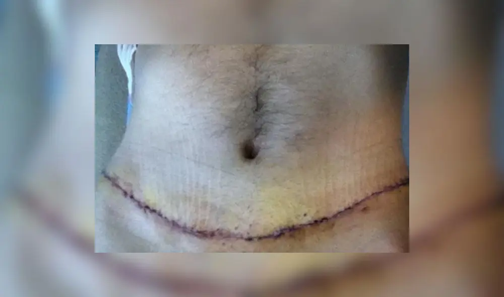 La Fundación LGBTadvirtió que los problemas de imagen corporal se están generalizando en la comunidad gay. Foto: Difusión.