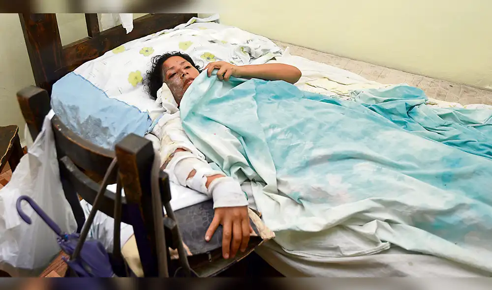 Hombre quema con agua hirviendo a exconviviente y a su propio hijo en SMP Hombre quema con agua hirviendo a exconviviente y a su propio hijo en SMP